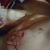  - Foto 1