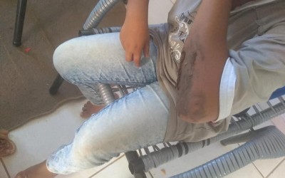 Criança é atacada por homem no bairro Guanabara em TL
