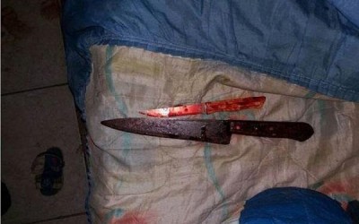 Mulher corta pênis do próprio irmão no Paraná