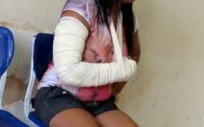 Após bebedeira em bar, mulher é espancada pelo marido no bairro Vila Alegre 