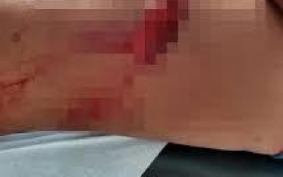 Mãe embriagada dá facada em filha de 10 anos em Araçatuba-SP