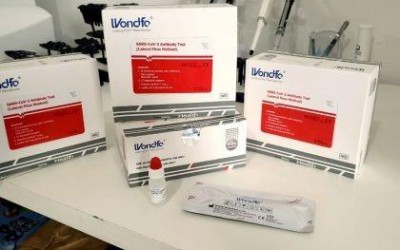 Três Lagoas já conta com 600 testes rápidos para COVID-19