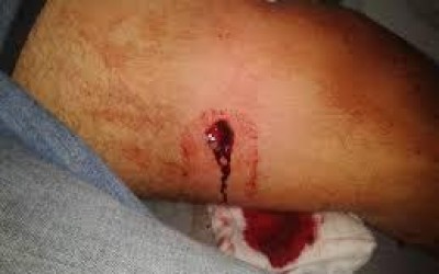 Troca de tiros na Vila Piloto deixa um inocente ferido 