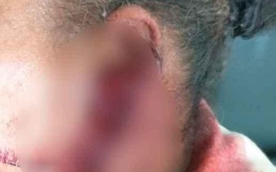 Após suspeita de traição mulheres brigam e uma delas é agredida com golpes de lanterna 