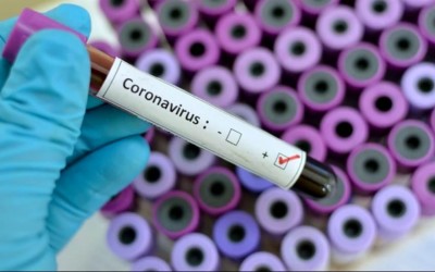 Covid-19: Três Lagoas chega aos 1.117 casos confirmados e já soma 19 mortes