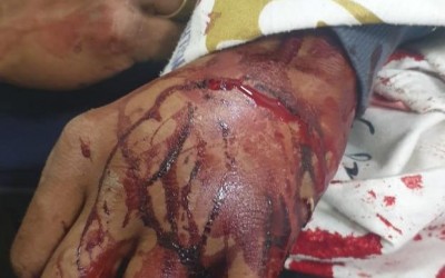 Homem em moto dispara três tiros contra pedestre no bairro Guanabara 