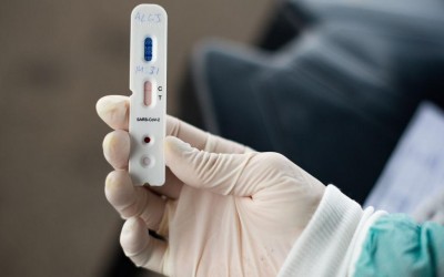 Com 14.529 notificações e 2.127 casos confirmados da Covid-19, mais 27 pessoas testaram positivo nesta terça-feira