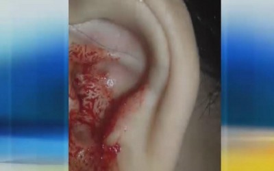 Após ser espancada por 30 minutos, ex enfia chave de moto no ouvido da vítima causando sangramento 