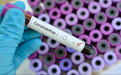 Ao contrário de outras cidades brasileiras, número da Covid-19 cai em Três Lagoas 