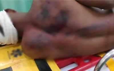 Em Andradina, adolescente é espancado por padrasto ao entrar em briga para defender a mãe