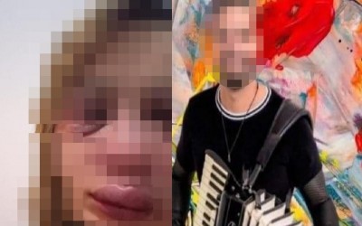 Namorada de cantor fica com rosto desfigurado após acusar sertanejo de agressões 