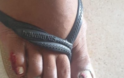 Após atropelar ex-mulher, homem agride vítima que ainda estava caída no chão 