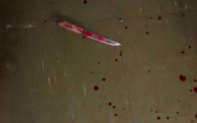 Mulher arranha testículos de companheiro durante briga