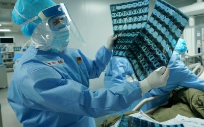 Covid-19: Saúde registra um óbito e outros 21 novos casos positivos