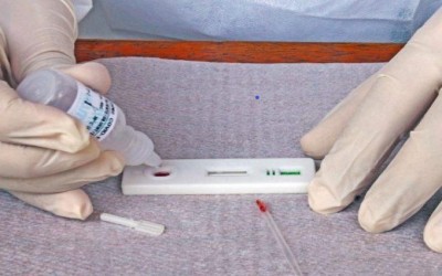 SES registra 2,6 mil casos e 16 novos óbitos por Covid