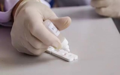 MS tem 1.646 novos casos de covid e 8 mortes em uma semana