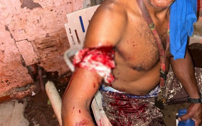 Briga entre homens causa esfaqueamento no bairro Santa Júlia 