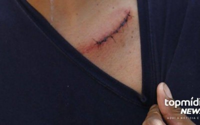 Por ciúmes, homem esfaqueia ex e amigo dela em Dourados