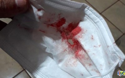 Jovem cospe sangue e morre em unidade de saúde em Dourados