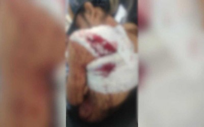 Homem leva facada nas costas durante briga em Aquidauana  