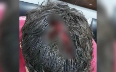 Jovem é baleado cinco vezes e fica em estado grave em Sonora  