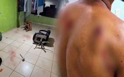 Adolescente encontra namorado com outra e esfaqueia casal em cidade de MS