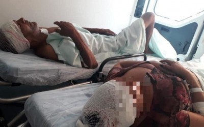 Grávida que sofreu tentativa de estupro teve perfuração no crânio