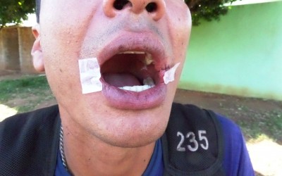 Mototaxista fica ferido com cerol em Três Lagoas