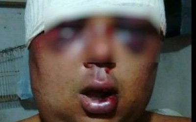 Cabeleireiro é brutalmente espancado na Praça Ramez Tebet