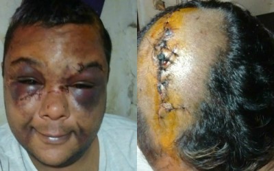 ‘’Saímos para matar veado’’, diziam agressores de homossexual em Três Lagoas