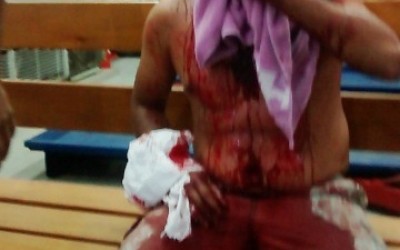 Homem tem rosto desfigurado ao ser ferido com caco de vidro