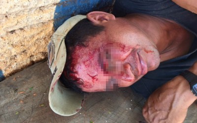 Amigos de “cachaça” brigam e um deles é ferido com bloco na cabeça 