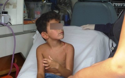 Menino de 06 anos cai de brinquedo e sofre traumatismo craniano