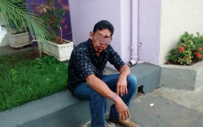  Homem fica ferido depois de ser agredido no centro de Três Lagoas