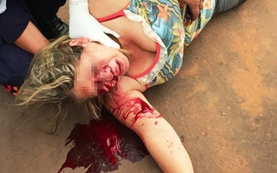 Mulher sofre ferimentos no rosto após acidente no Jardim Flamboyant