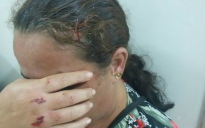 Mulher arremessa panela com óleo quente no marido e é agredida com bloco pela vítima