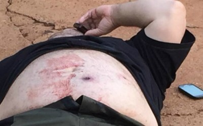 Mãe de jovem baleado por irmão acusa nora por co-autoria no crime 