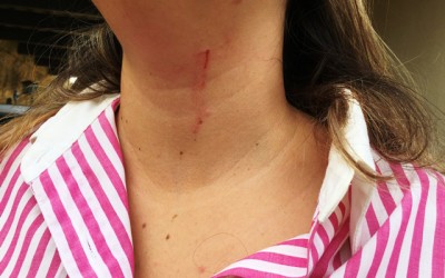 Professora universitária feita refém em assalto é agredida e amarrada no Jardim dos Ipês
