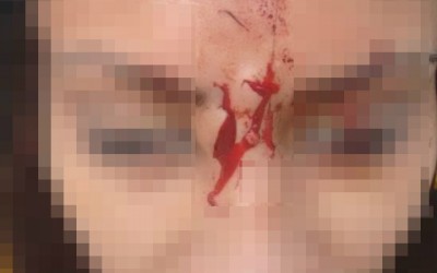 Briga entre sogra e nora termina com a chegada da Polícia Militar 