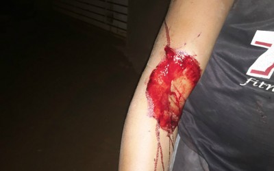 Para se defender de agressões, mulher esfaqueia o marido por duas vezes 