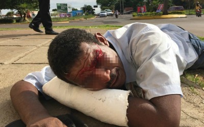 “Bebum” encontrado com corte na cabeça disse que foi agredido 