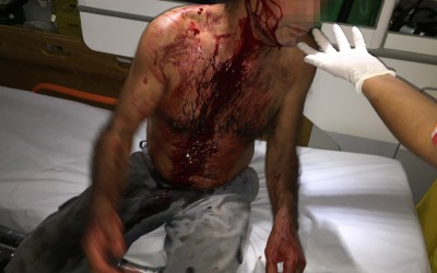 Operador de máquina agredido com taco de sinuca é socorrido pelo SAMU 