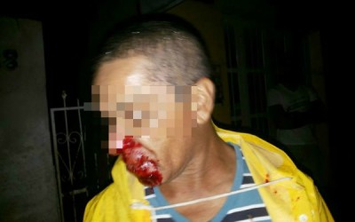 Acidente entre carro e bicicleta deixa ciclista ferido em Três Lagoas 