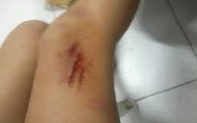 Para não ser morta, mulher precisa pular muro e pedir por socorro na casa do vizinho