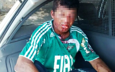 Andarilho é agredido no rosto em tentativa de assalto 