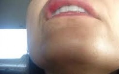 Mulher morde braço do marido para não ser amarrada com corda 