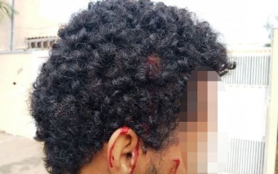 Jovem é agredido com barra de ferro e pedaço de pau 