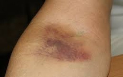 Traições no casamento geram brigas, agressões e prisão de marido 