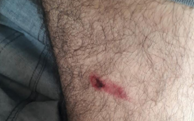 Polícia atira em homem enfurecido que resistiu à prisão