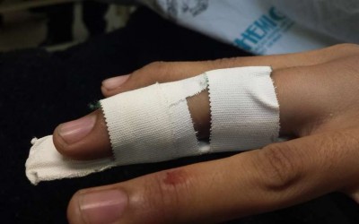 Mulher sofre suposta fratura no dedo após ser agredida pelo marido 